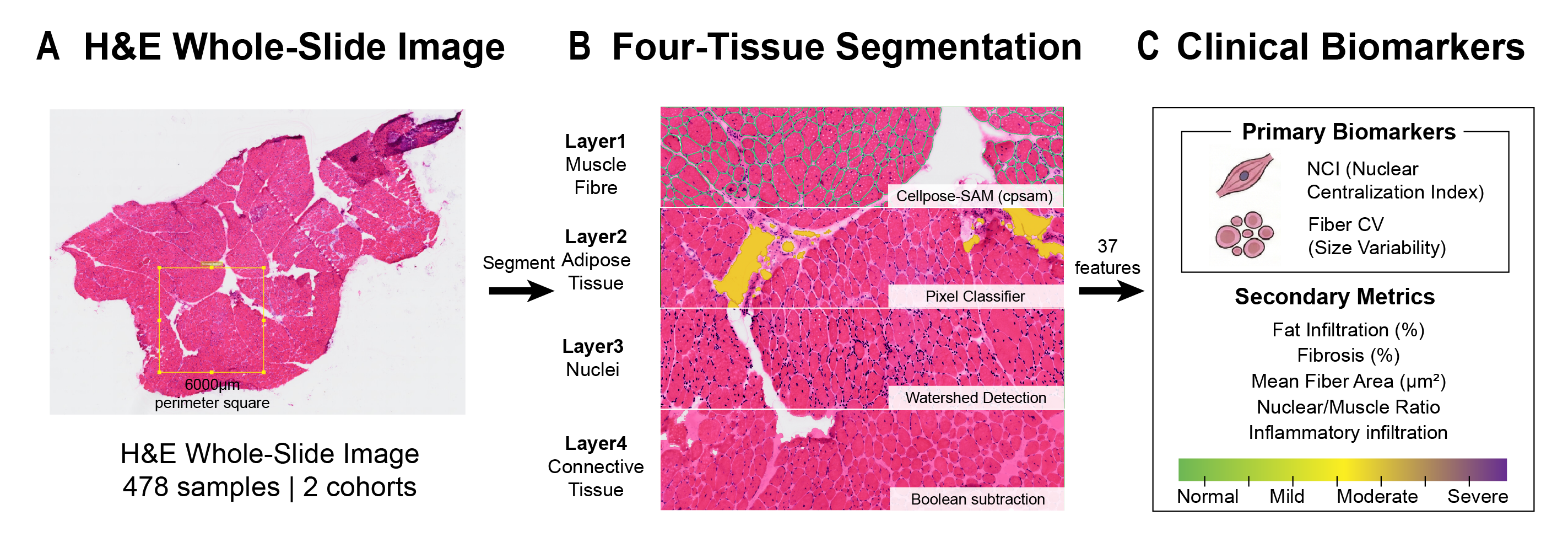 MyoPath Pipeline Flowchart