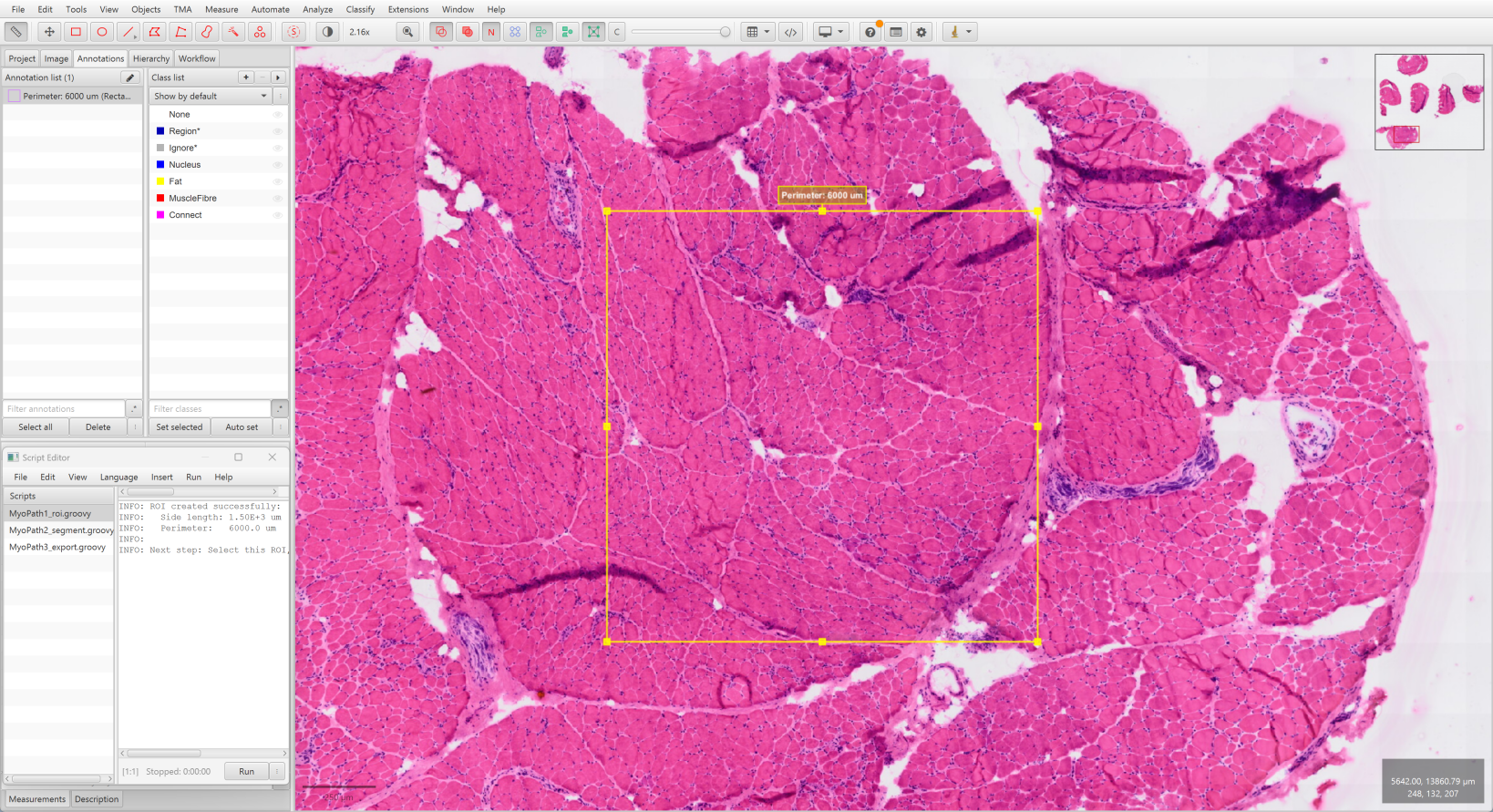 Step 1 — ROI created in QuPath