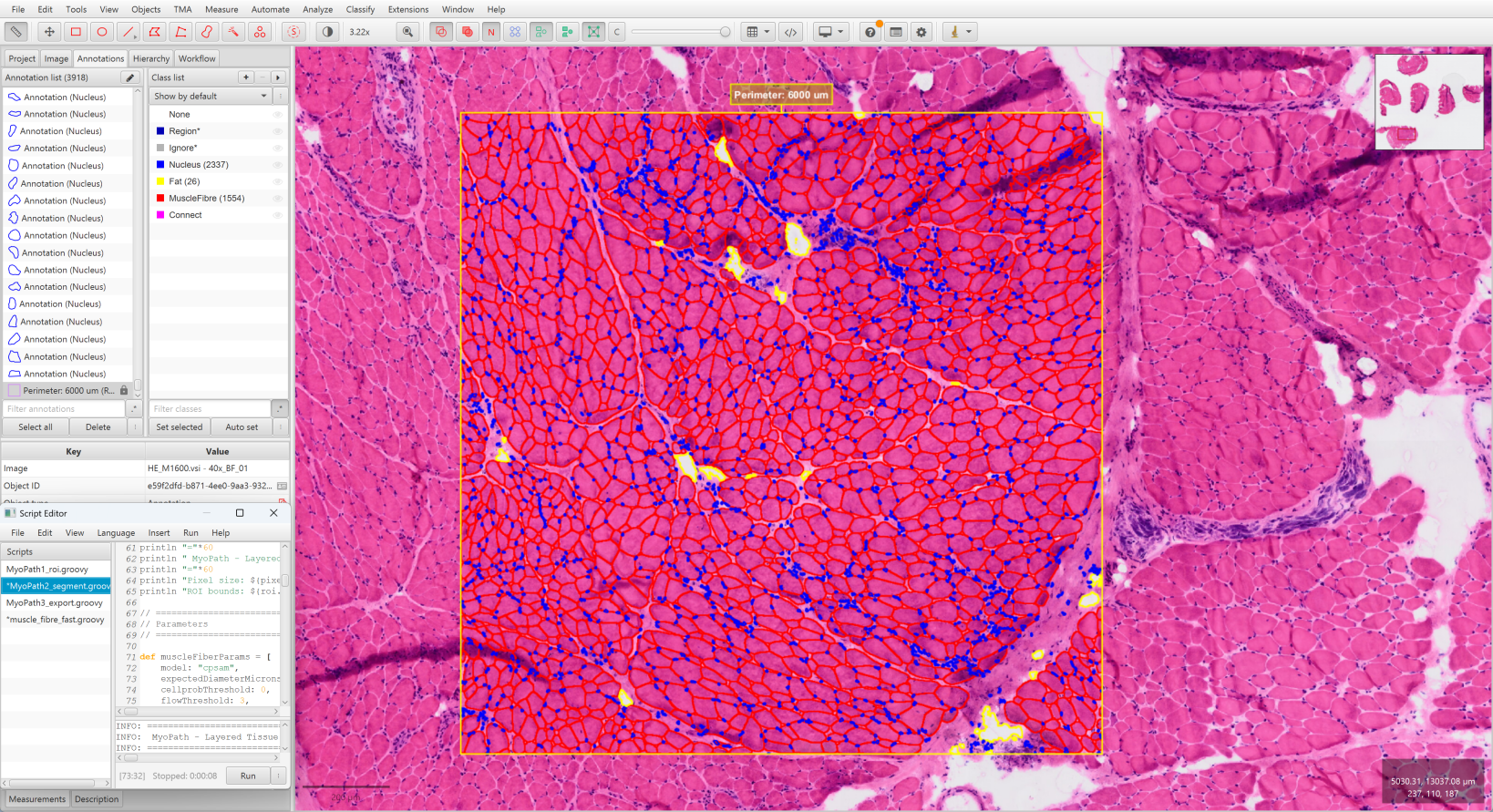 Step 2 — Segmentation result in QuPath